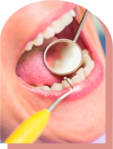 mirror and dental explorer in mouth