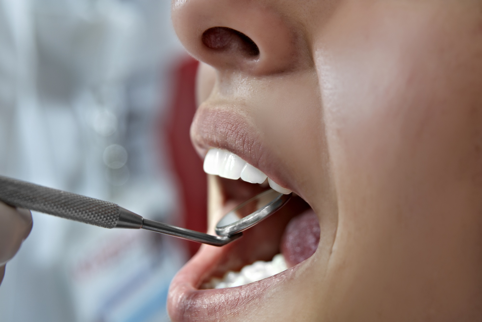 Selective focus shot of dentist examing mouth